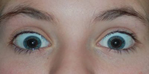 vörös szem effektus